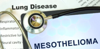 Mesothelioma