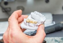Dental Bridge vs Implant: Comparison