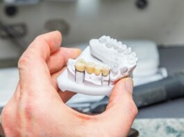Dental Bridge vs Implant: Comparison
