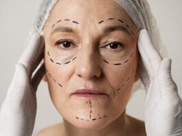 Deep Plane Facelift-What to know