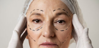 Deep Plane Facelift-What to know