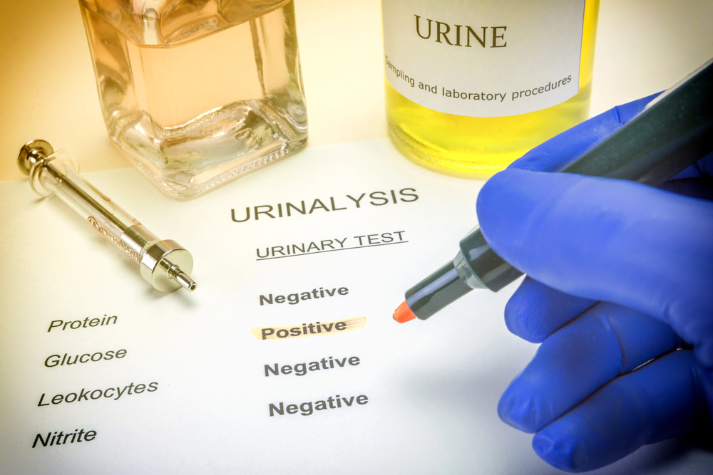 Improving Reproducibility in Urinalysis: Medical Applications of Synthetic Urine Formulations