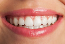 Teeth Straightening Options: Which Is Right for You? Teeth Straightening Options