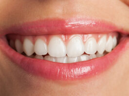 Teeth Straightening Options