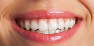 Teeth Straightening Options