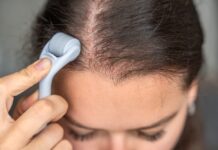 Derma Rollers Can Boost Hair Growth