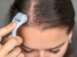 Derma Rollers Can Boost Hair Growth